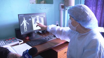 У Попільнянській лікарні на Житомирщині запрацювала нова рентгенустановка