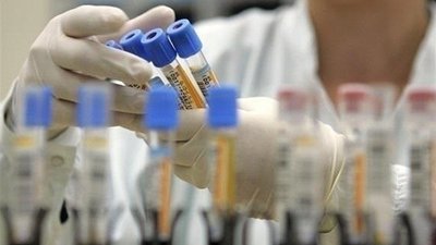 За добу на Сумщині виявили 254 людини з COVID-19