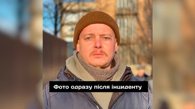 Побиття актора Чернігівського драмтеатру: що кажуть у поліції та як це прокоментував директор театру у Дніпрі Побиття актора Чернігівського драмтеатру: що кажуть у поліції та як це прокоментував директор театру у Дніпрі