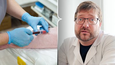 Колаж: зліва — беруть кров із вени, з права — лікар-онколог Володимир Барателі