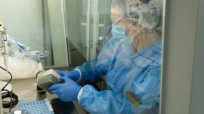 Житомирський обласний лабораторний центр починає виявляти штам коронавірусу "Дельта" самостійно