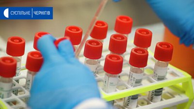 На Чернігівщині за добу коронавірус виявили у двох людей