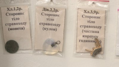 "Хочуть спробувати на зуб": лікар-ендоскопіст з Рівного показав, що найчастіше ковтають діти "Хочуть спробувати на зуб": лікар-ендоскопіст з Рівного показав, що найчастіше ковтають діти