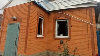 Жінка, яка отримала поранення через обстріли РФ на Сумщині, померла у лікарні