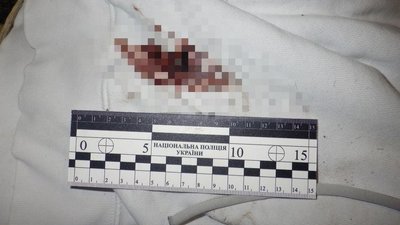 прокуратура, суд, побиття, підлітки, апеляція, інвалідність