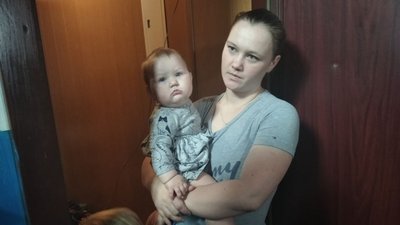 Житомирські лікарі стабілізували стан дворічної дівчинки, котра випала з вікна третього поверху Житомирські лікарі стабілізували стан дворічної дівчинки, котра випала з вікна третього поверху