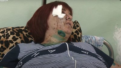 В Одесі пластичний хірург безкоштовно оперує травмованих після ракетного удару по Сергіївці. ВІДЕО В Одесі пластичний хірург безкоштовно оперує травмованих після ракетного удару по Сергіївці. ВІДЕО