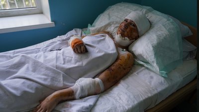 "Я чекаю чуда — живого сина": у Кременчуці зашивають рани та ховають мертвих. СУСПІЛЬНЕ | ВІДЕОНОВИНИ