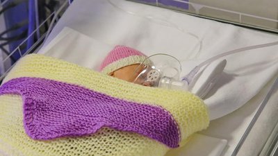 Вироби як лялькові. Буковинка в'яже речі для передчасно народжених дітей. СУСПІЛЬНЕ | ЛЮДИ Вироби як лялькові. Буковинка в'яже речі для передчасно народжених дітей. СУСПІЛЬНЕ | ЛЮДИ