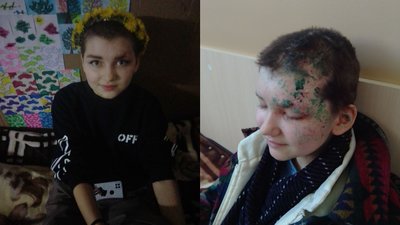 "Тебе любитимуть попри шрами": історія дівчинки, яка вижила під час обстрілу у Чугуєві "Тебе любитимуть попри шрами": історія дівчинки, яка вижила під час обстрілу у Чугуєві