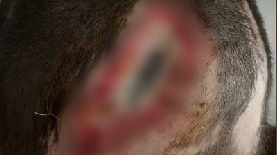 Пережив клінічну смерть та повернувся на службу: історія нацгвардійця з Хмельниччини Пережив клінічну смерть та повернувся на службу: історія нацгвардійця з Хмельниччини