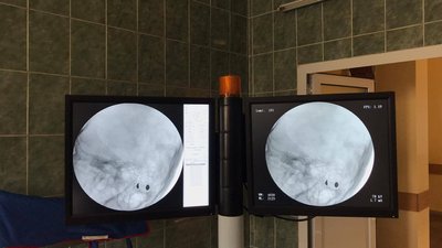 Медики розповіли про стан охоронця, у якого вистрілили у центрі Львова Медики розповіли про стан охоронця, у якого вистрілили у центрі Львова