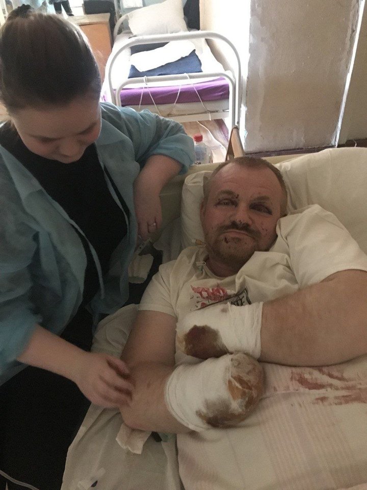 «Я щасливий на сто відсотків»: як ветеран Андрій Олійник повертається до життя після втрати обох рук на війні