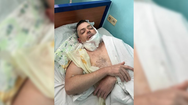 «Досвід, якого би хотіла не мати»: як хірургиня з Чернігова відновлює обличчя пораненим на фронті воїнам