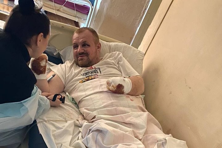 «Я щасливий на сто відсотків»: як ветеран Андрій Олійник повертається до життя після втрати обох рук на війні