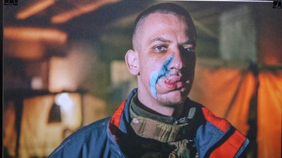 Фото полоненого азовця Дмитра Козацького з Житомирщини здобули переможні місця на фотовиставці у Парижі